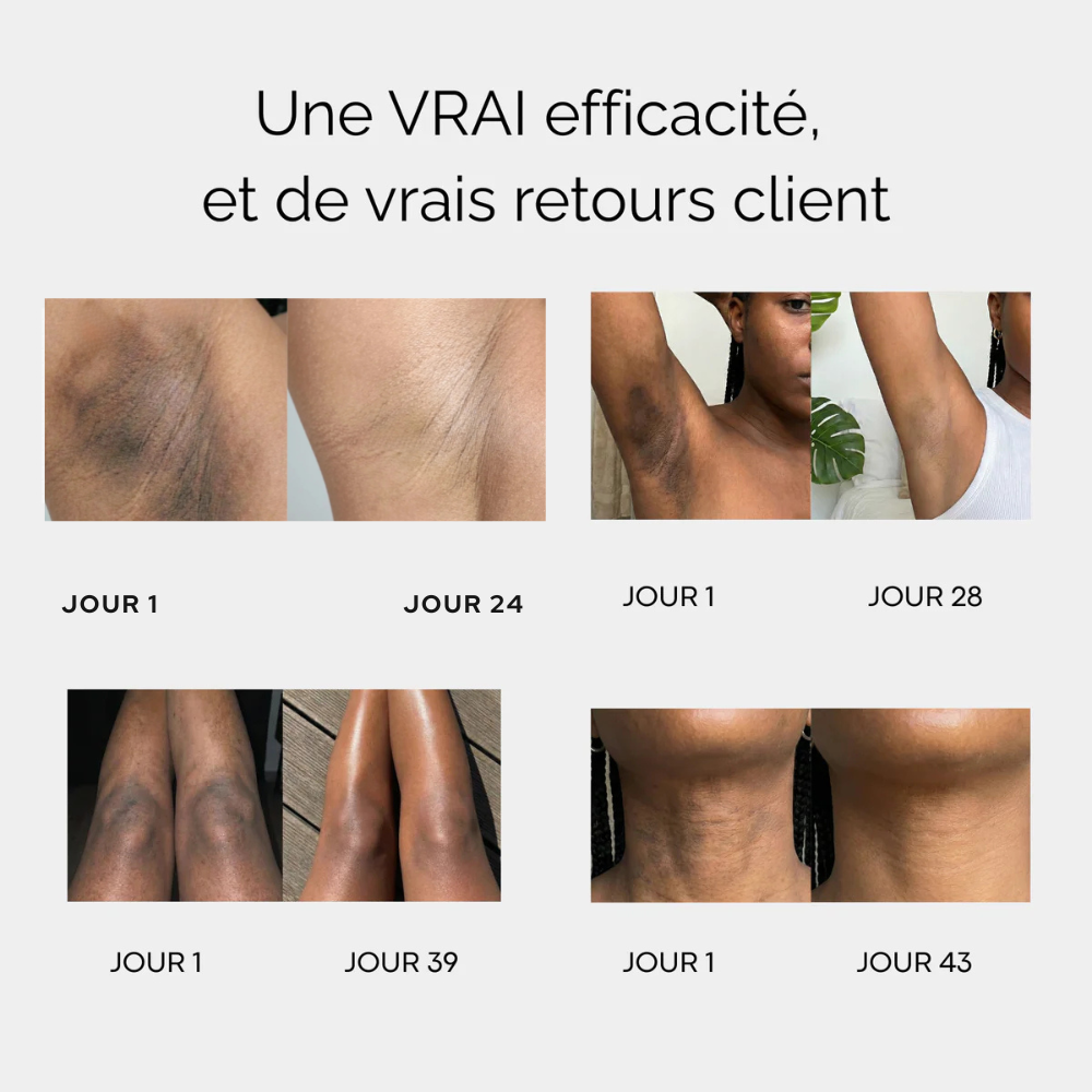 Savon éclaircissant au curcuma et à l'acide kojique - KUMA™